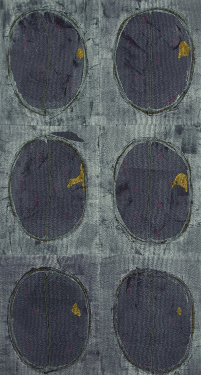 Brain